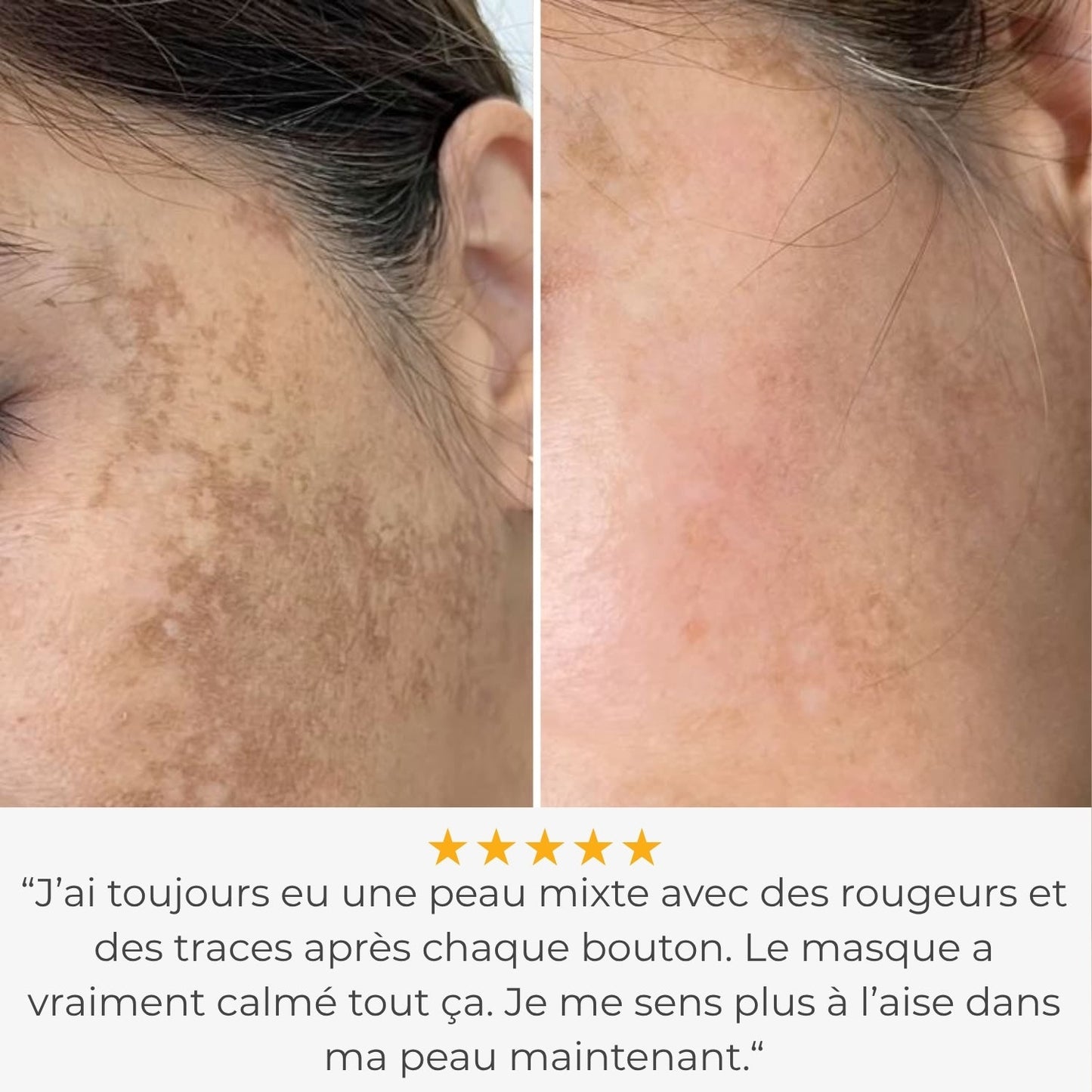 Glowskin Pro2 - Masque LED Haute Performance pour le Visage et le Cou