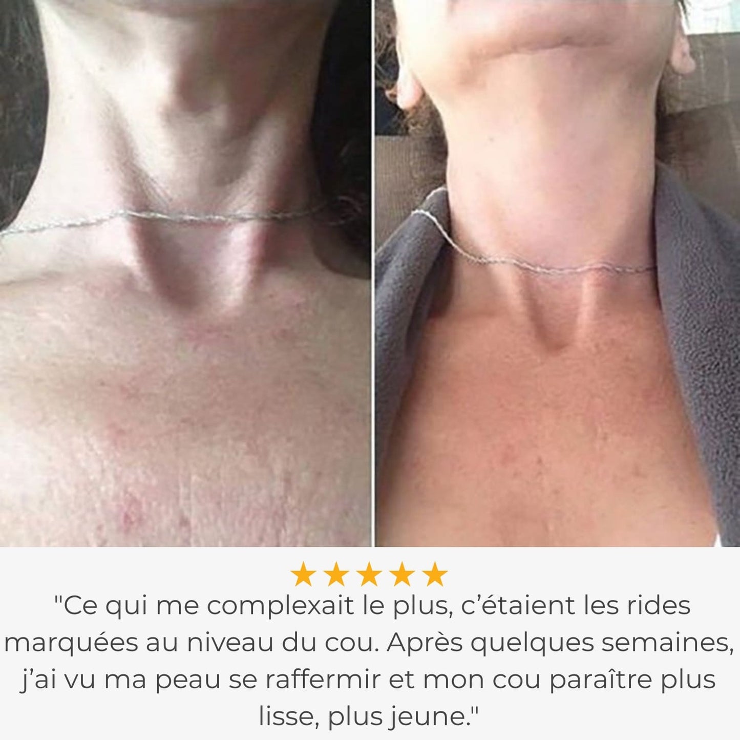 Glowskin Pro2 - Masque LED Haute Performance pour le Visage et le Cou